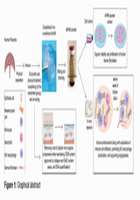INJECTABLE EXTRACELLULAR MATRIX MICROPARTICLES FOR REGENERATIVE AND BIOCOMPATIBLE SOFT TISSUE AUGMENTATION